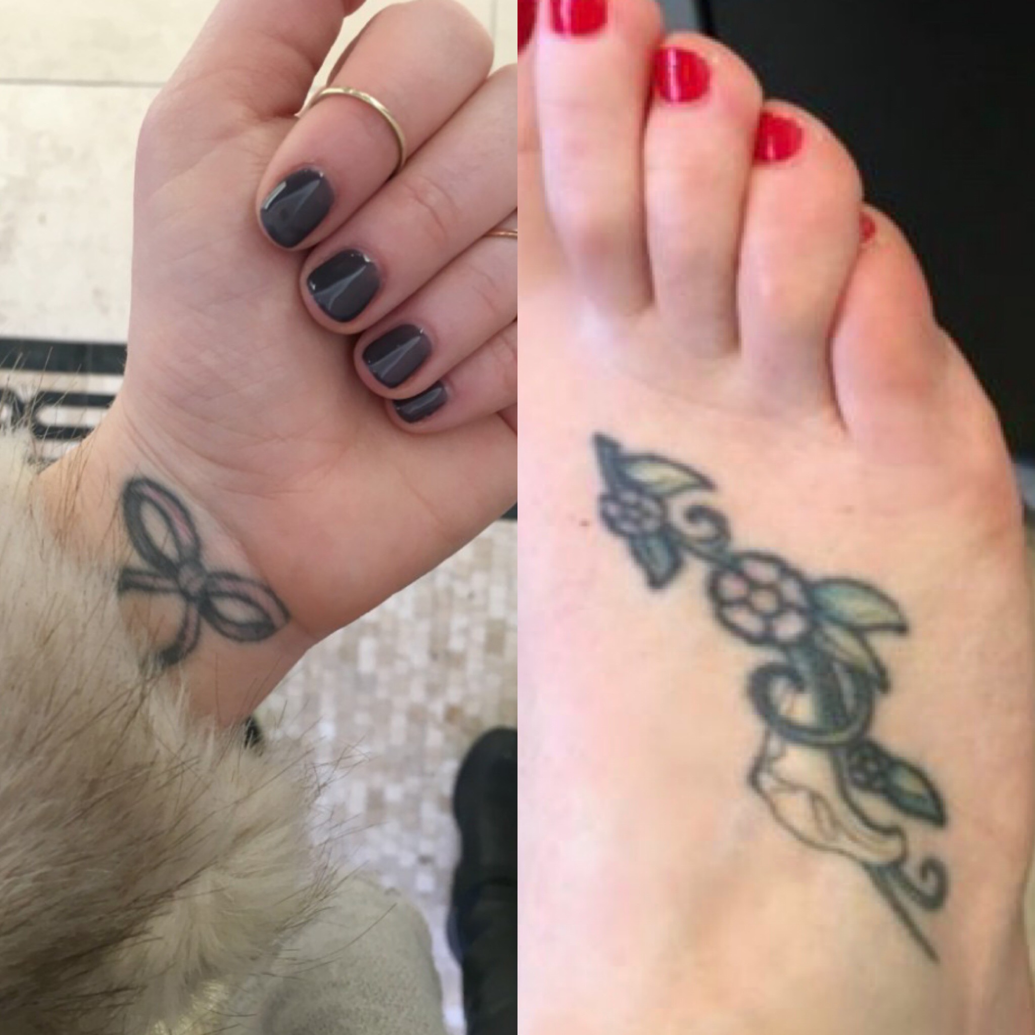 My Experience with Laser Tattoo Removal in NYC (before & after)